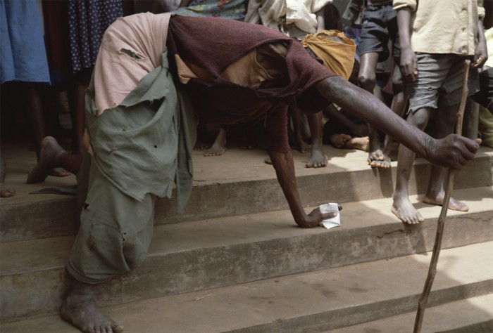 Clinic, Uganda, 1988